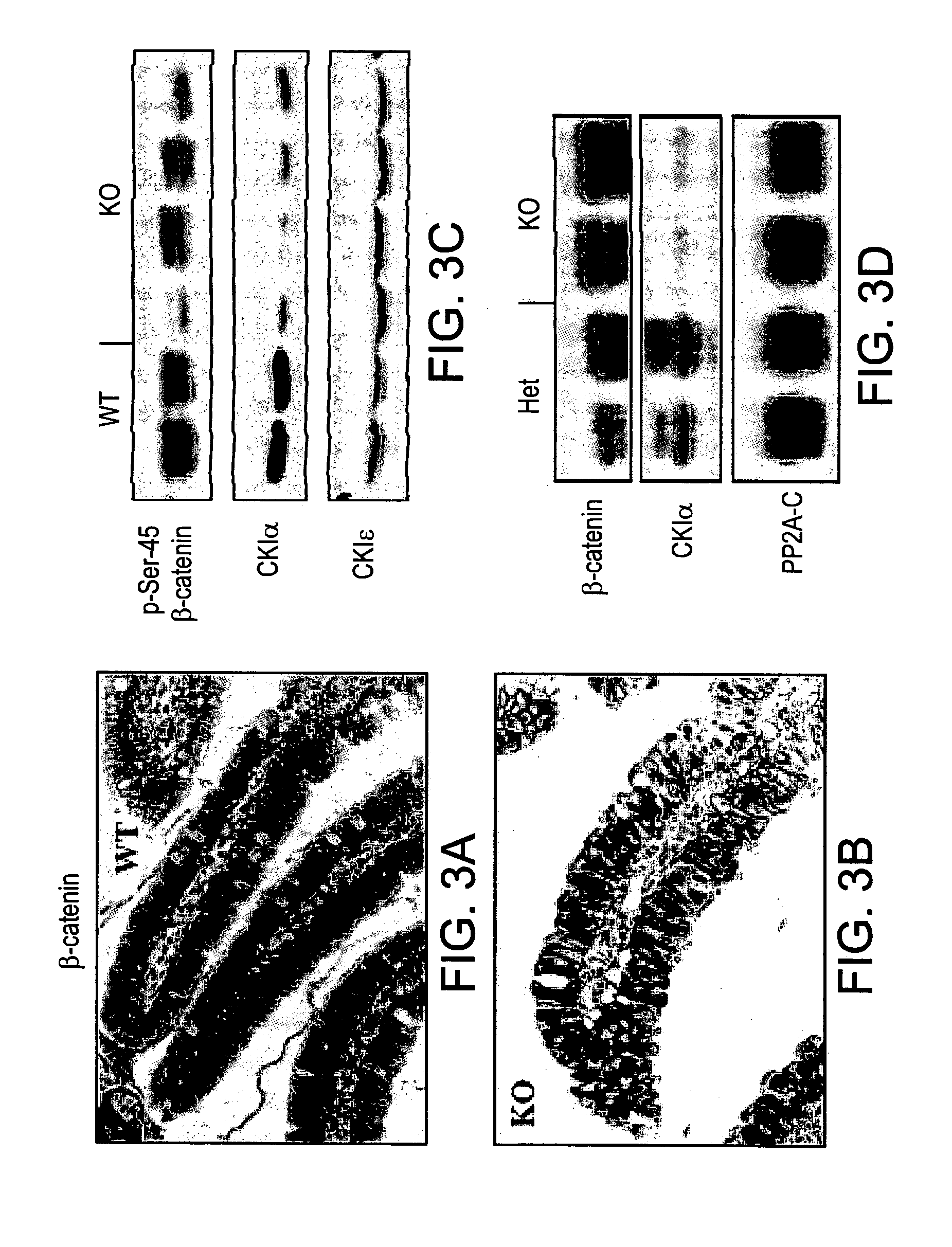 Methods of killing cells and use of same in prevention and treatment of cancer