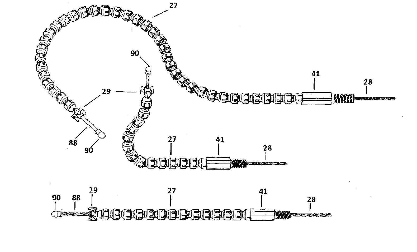System for Excising Anal Fistula Traces