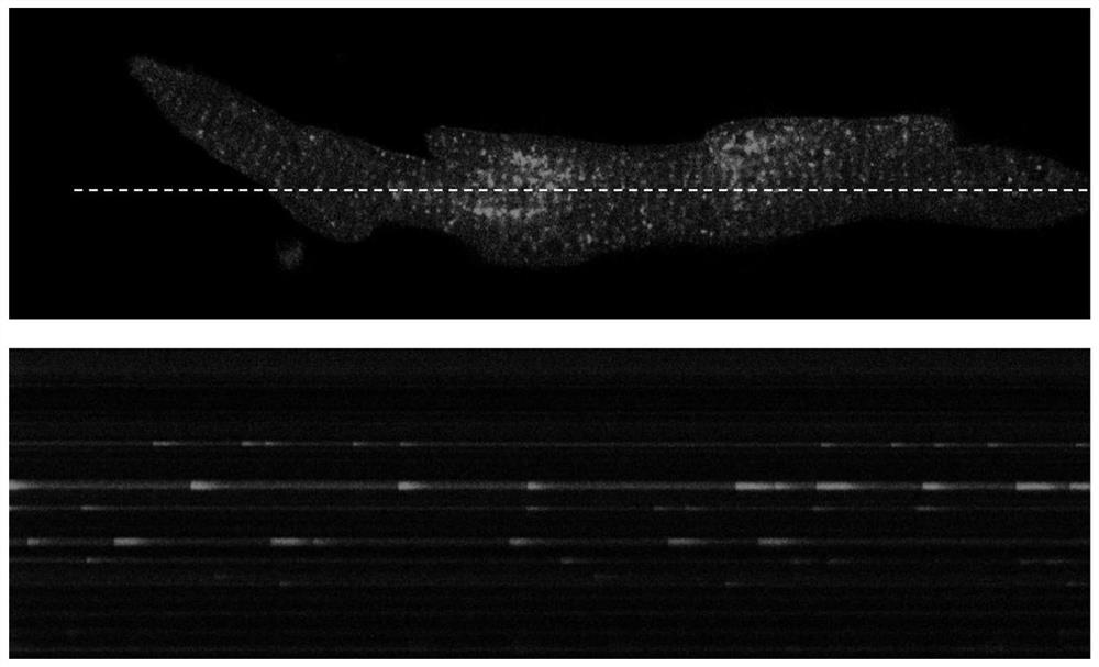 A method for isolation and culture of adult mouse atrial myocytes