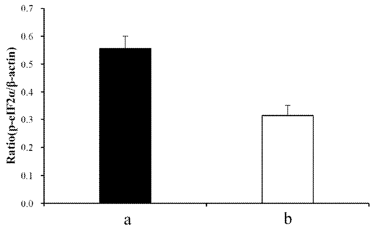 Ameliorative effects of a whole coffee fruit extract on age-related neurodegenerative disease