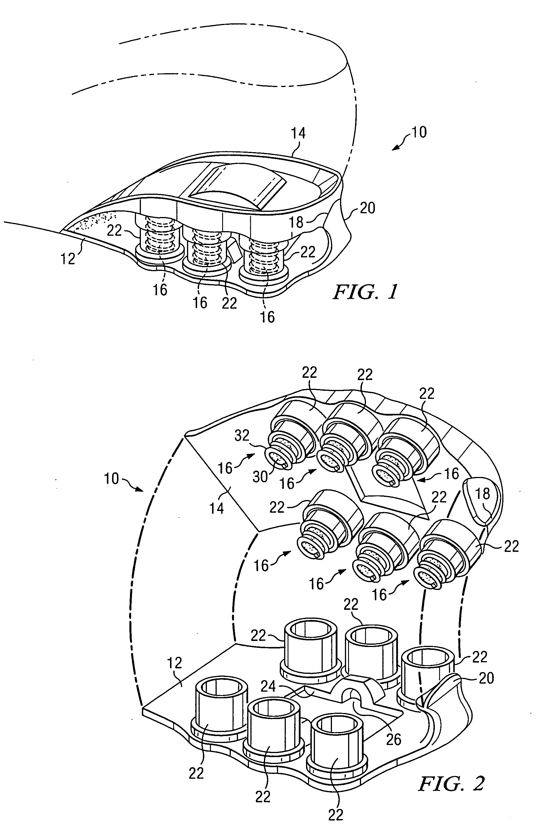 Wheeled footwear with spring suspension system