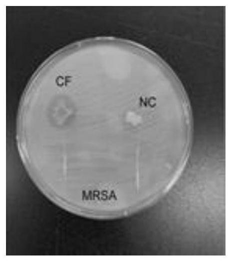 Novel multifunctional wound dressing for treating chronic wounds