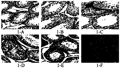 Novel application of traditional Chinese medicine composition to preparing kidney-Yang deficiency treating and preventing drugs