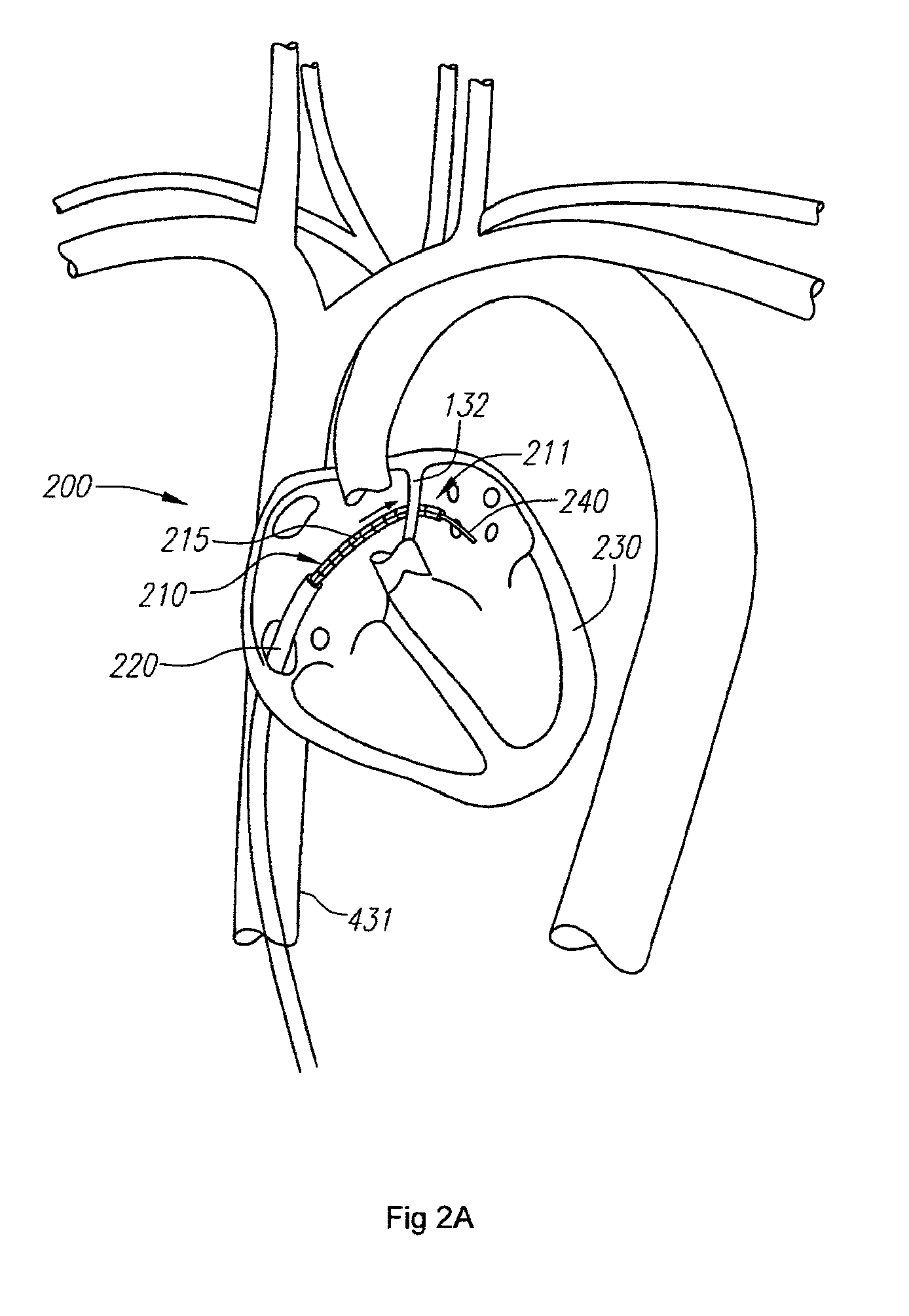 Fiber optic instrument shape sensing system and method