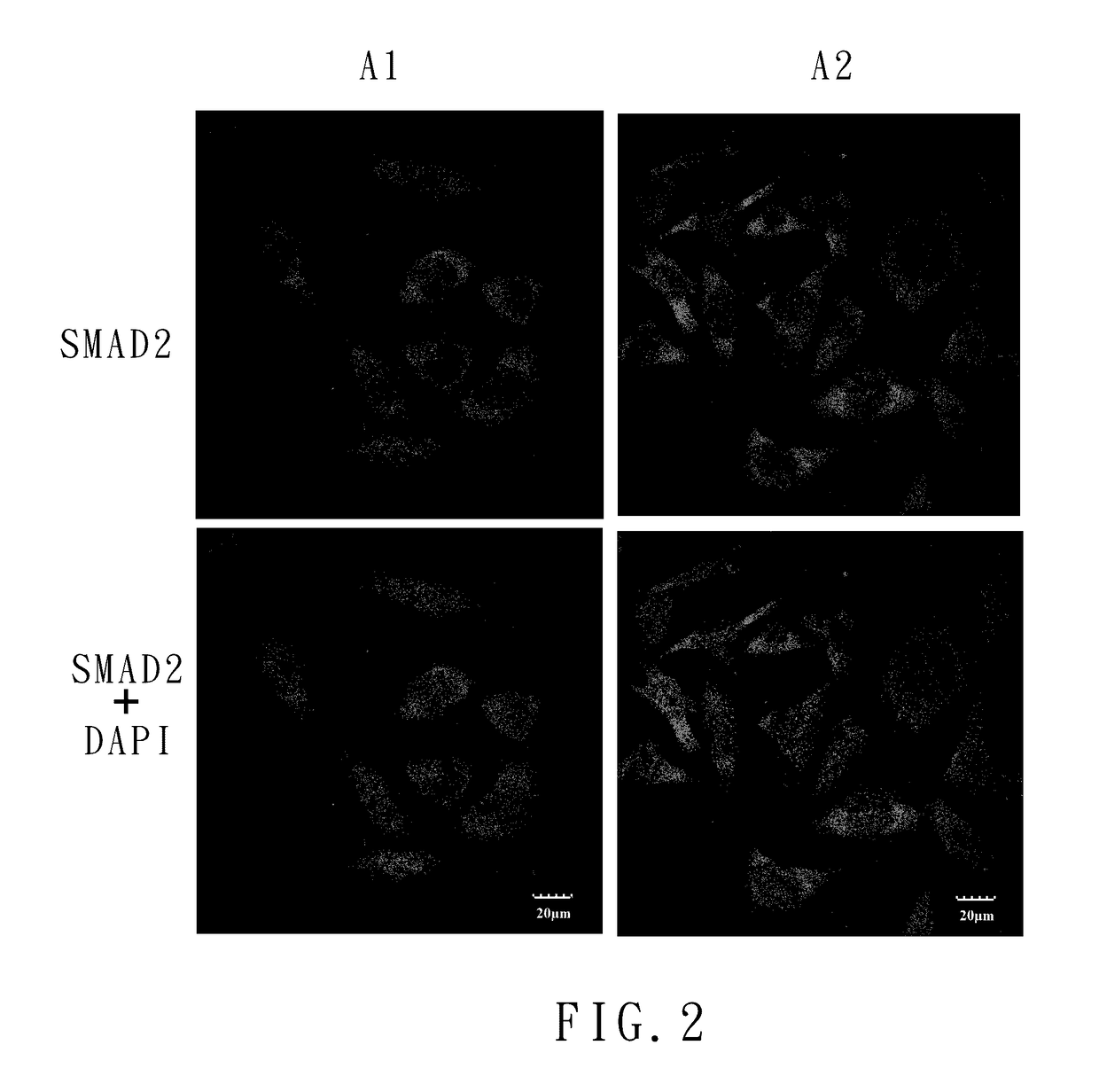 Method of therapy and diagnosis of endothelial dysfunction