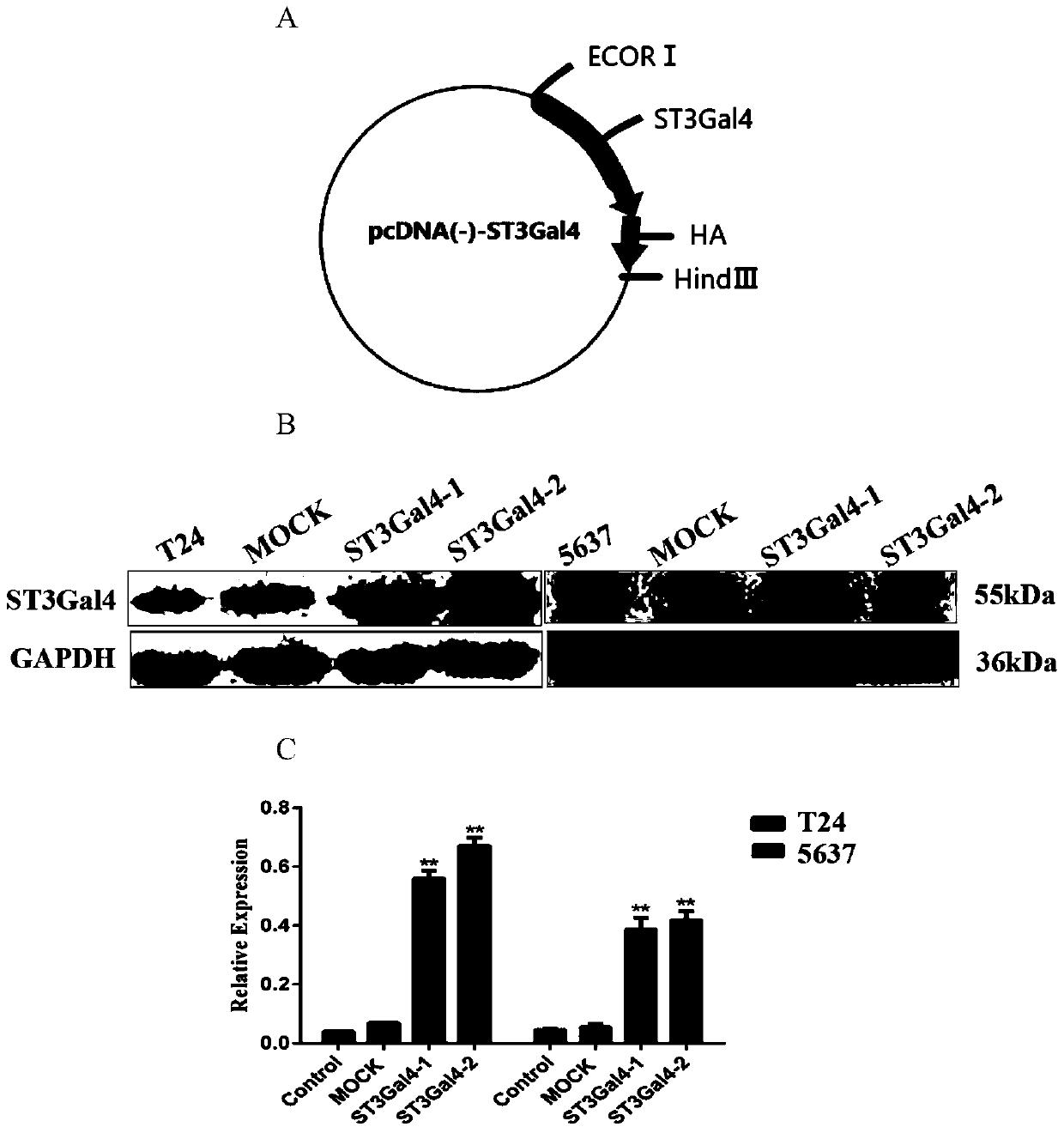Sialyltransferase recombinant plasmid and application of sialyltransferase recombinant plasmid and pemetrexed the preparation of medicament for inhibiting proliferation and invasion of bladder cancer