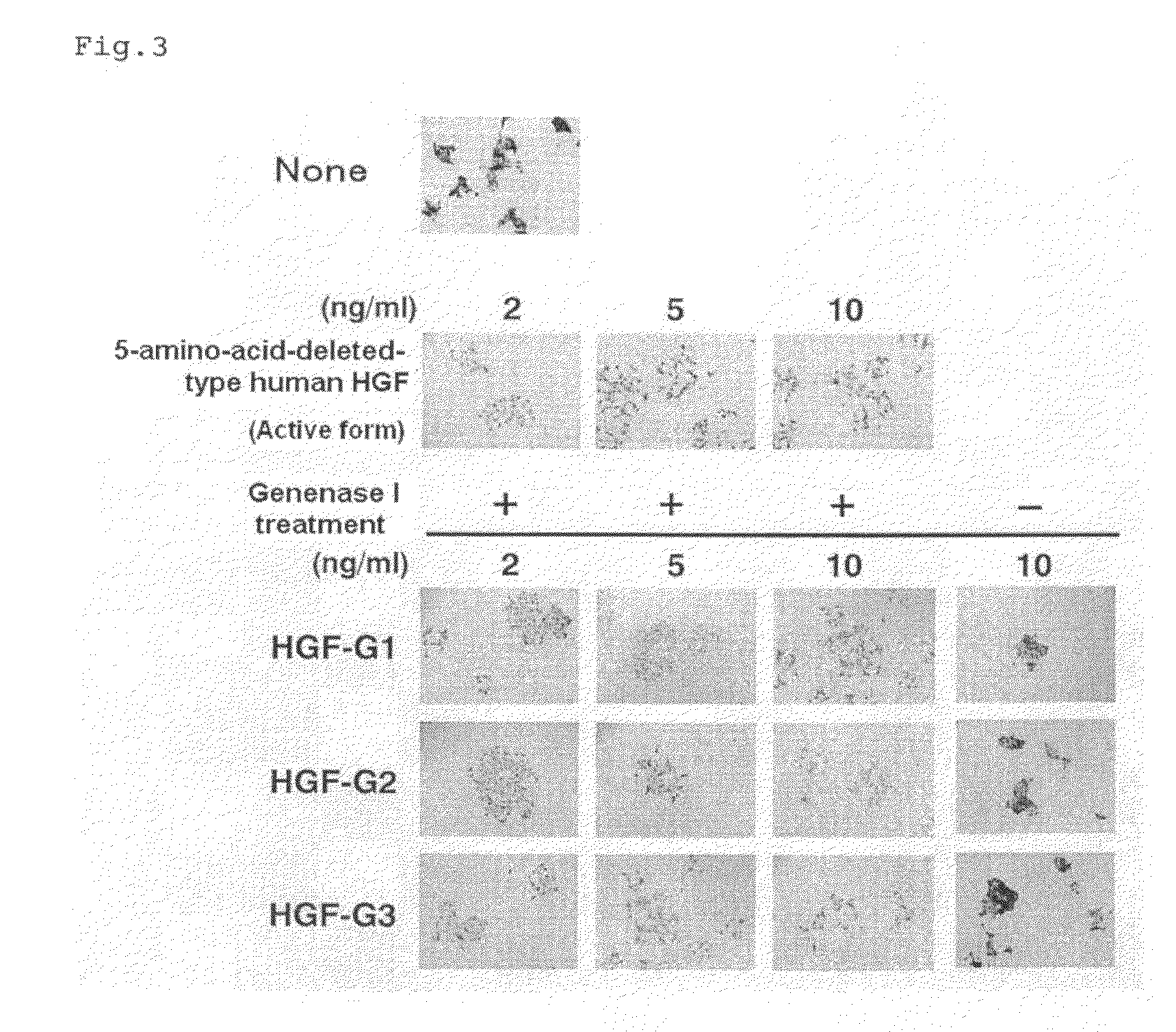 Hgf Precursor Protein Variant and Active Protein Thereof