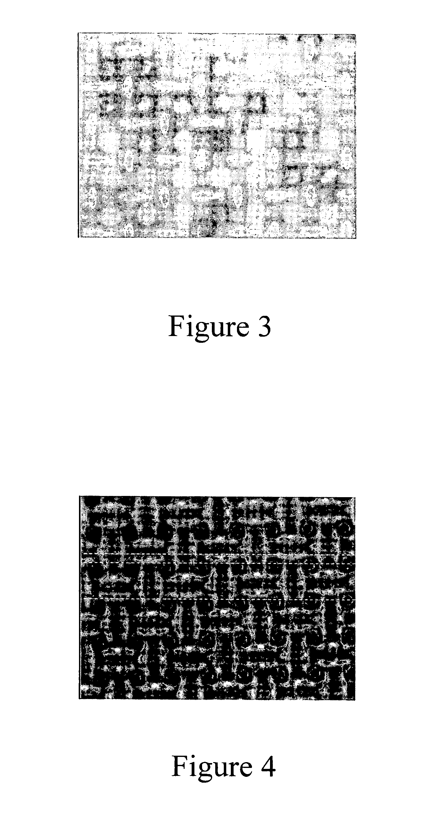 Transdermal delivery system for dried particulate or lyophilized peptides and polypeptides