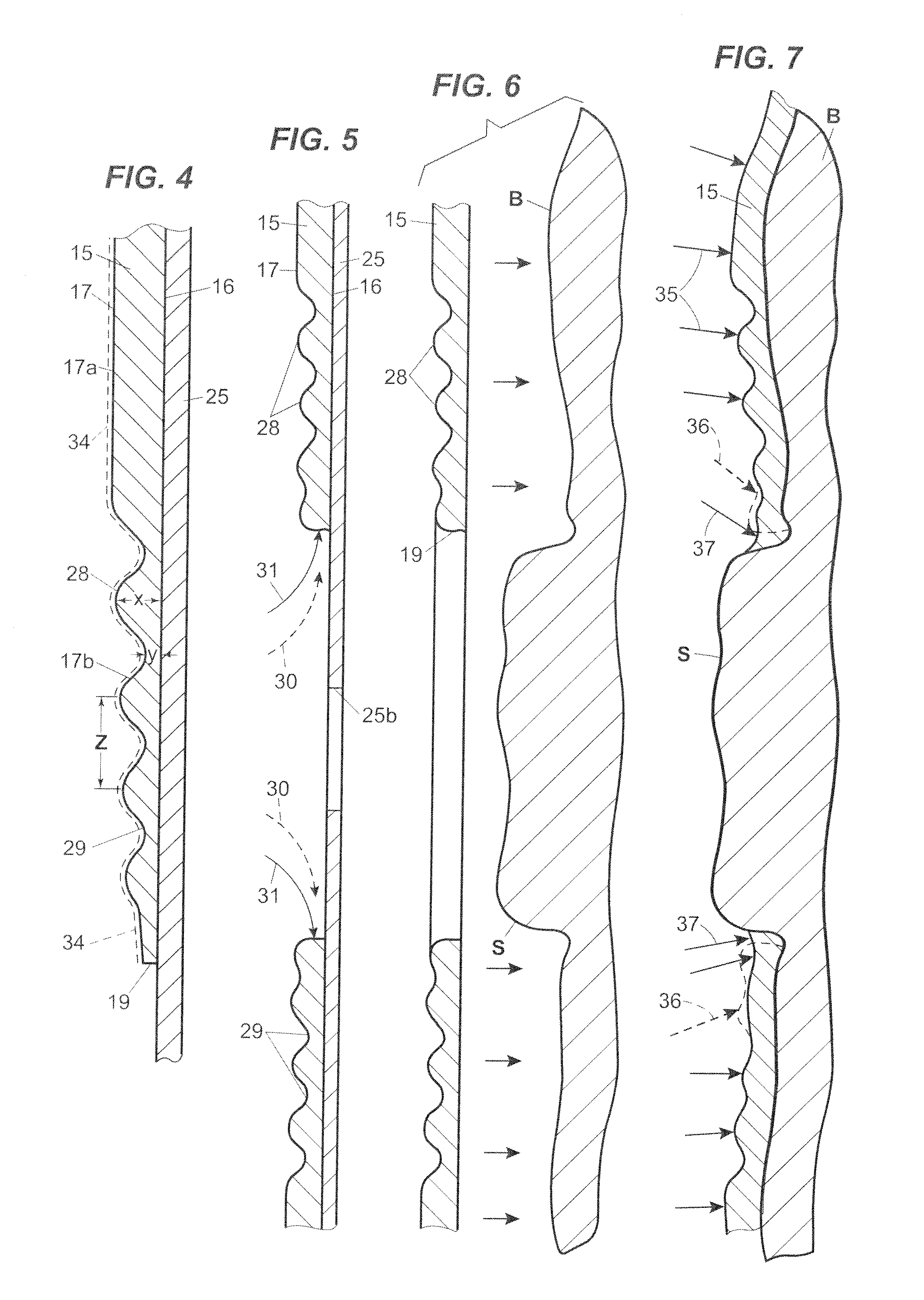 Ostomy faceplate having moldable adhesive wafer with diminishing surface undulations