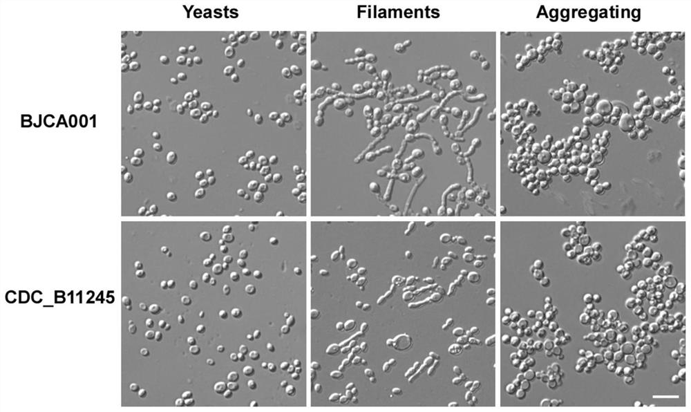 Application of myriocin and fingolimod in aspect of inhibiting candida auricula