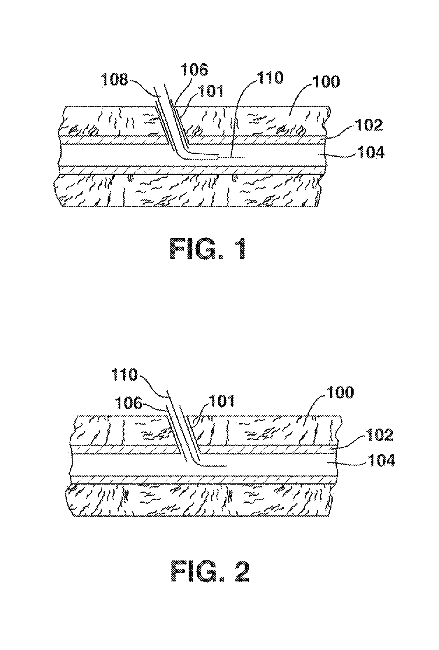 Low-Profile Vasculare Closure Systems and Methods of Using Same