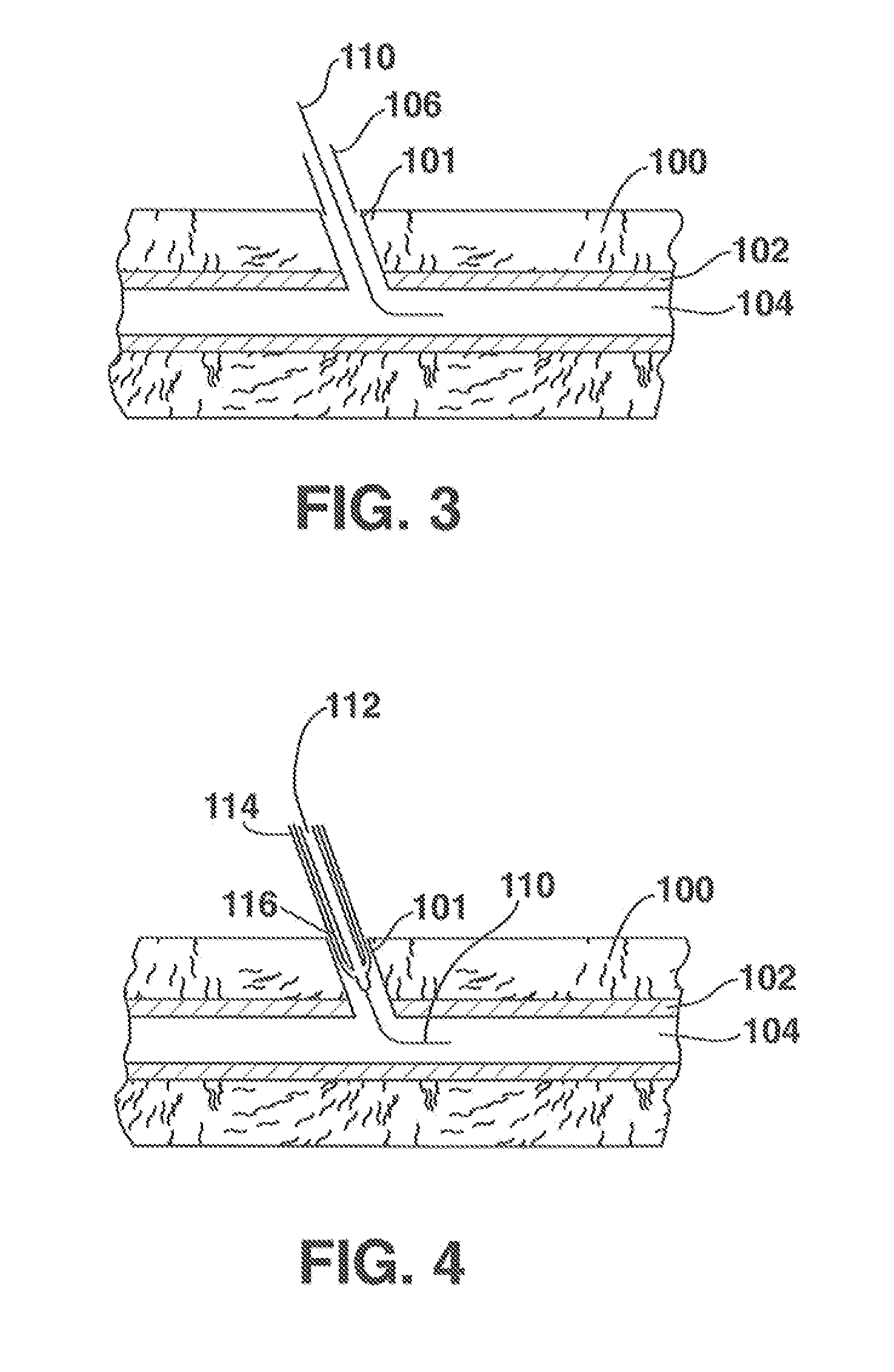 Low-Profile Vasculare Closure Systems and Methods of Using Same