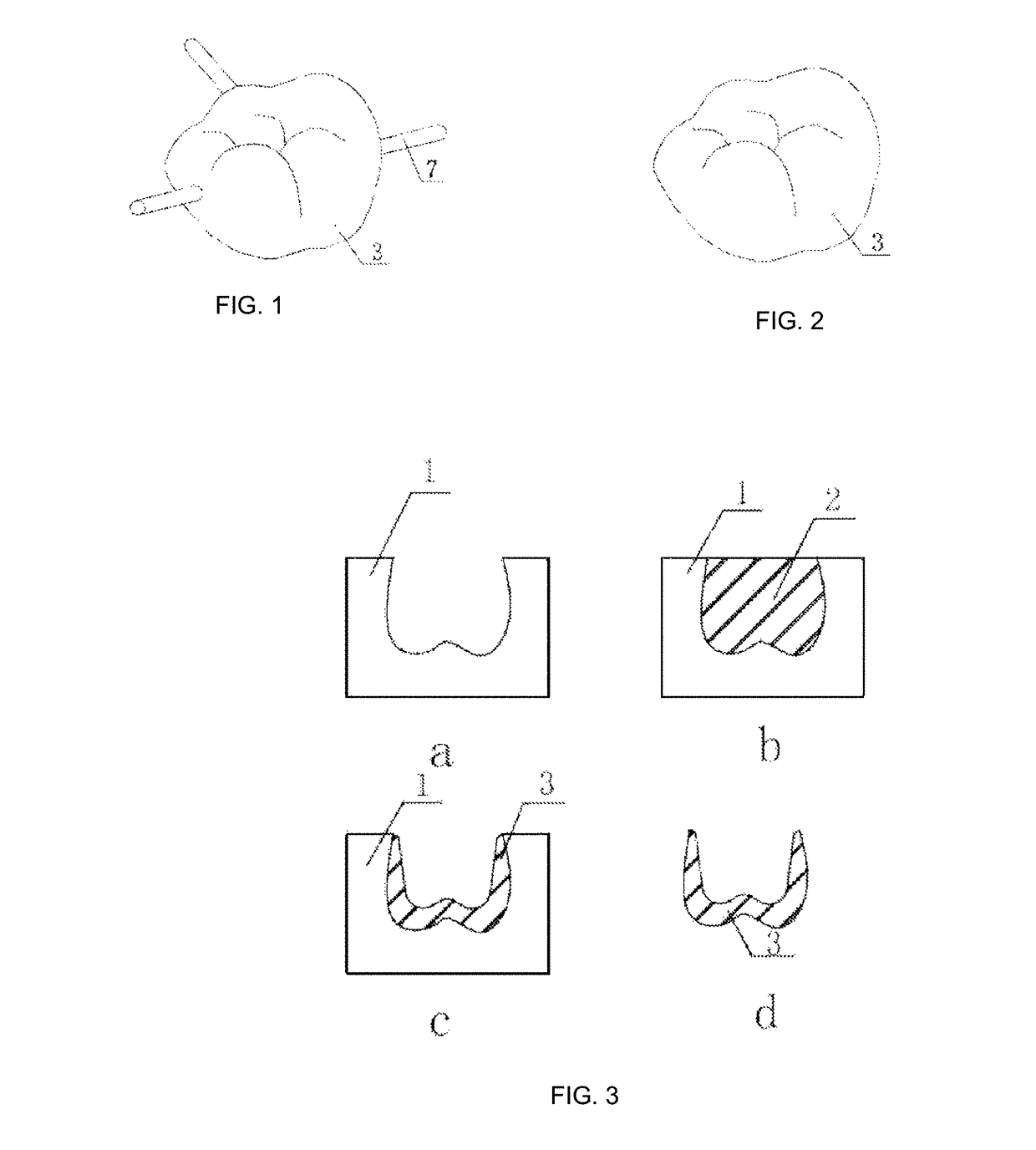 Dental all-ceramic restoration and manufacturing method thereof