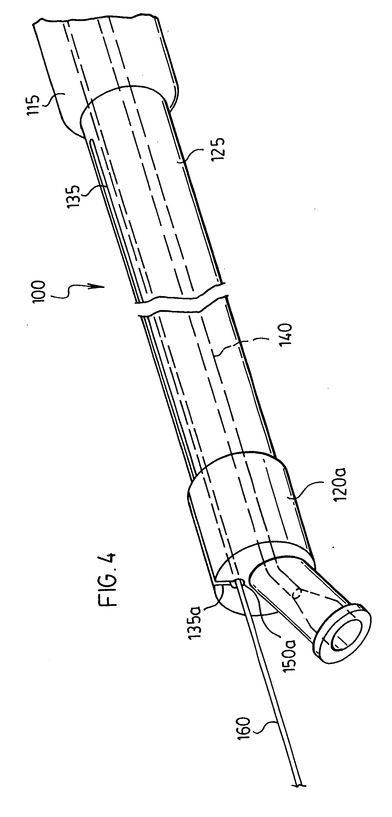 Stent delivery system and method of use