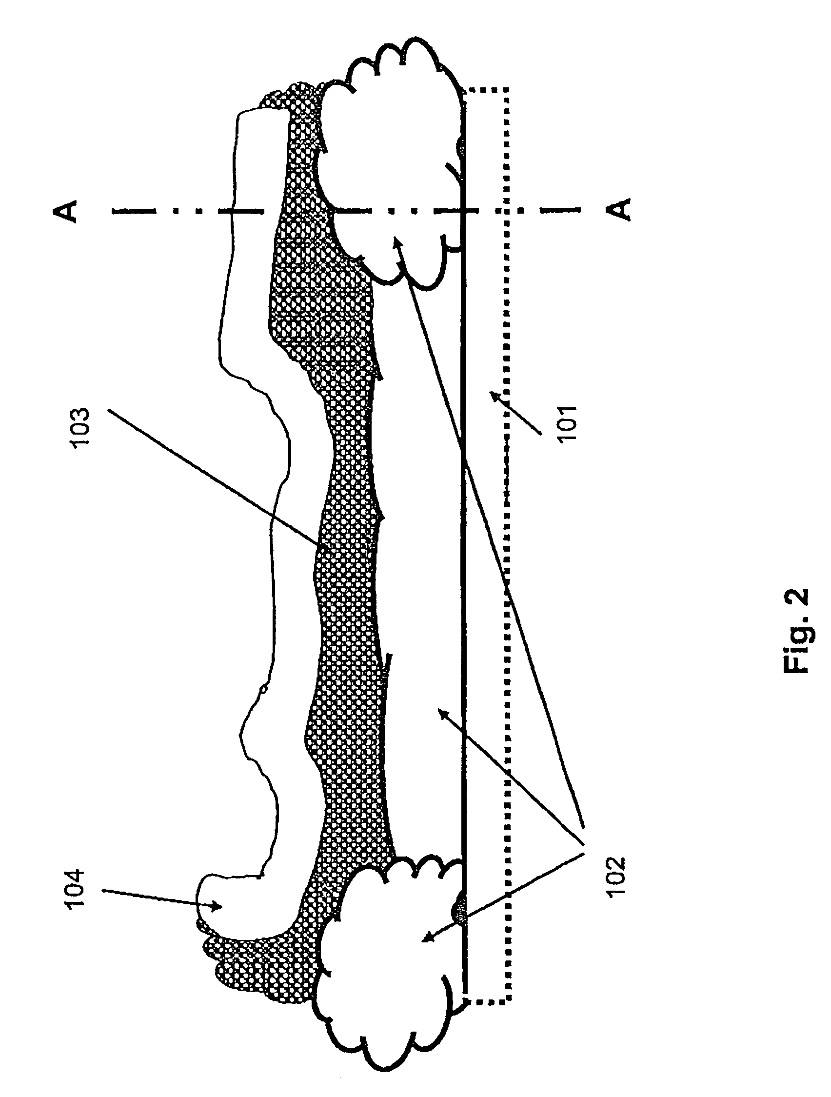 Device and method for carefully settling a patient in a defined position