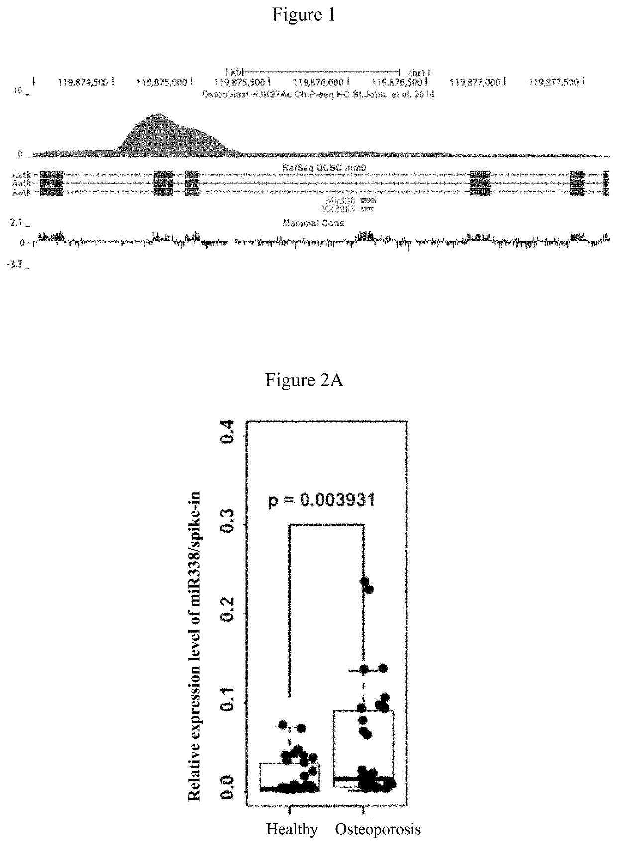 Mirna marker and kit associated with postmenopausal osteoporosis