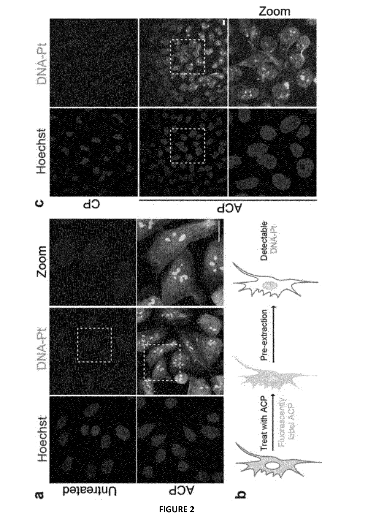 Visual detection of platinated DNA lesions from a clickable cisplatin probe used as diagnostic tool or to identify synergistic treatments