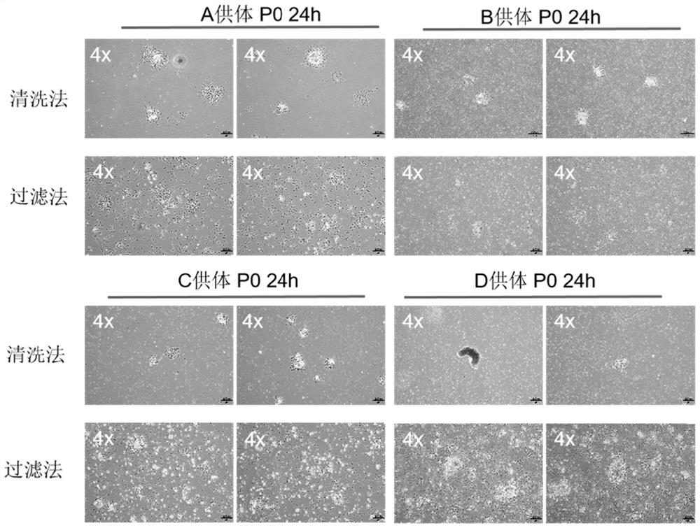 Method for preparing menstrual blood-derived mesenchymal stem cells