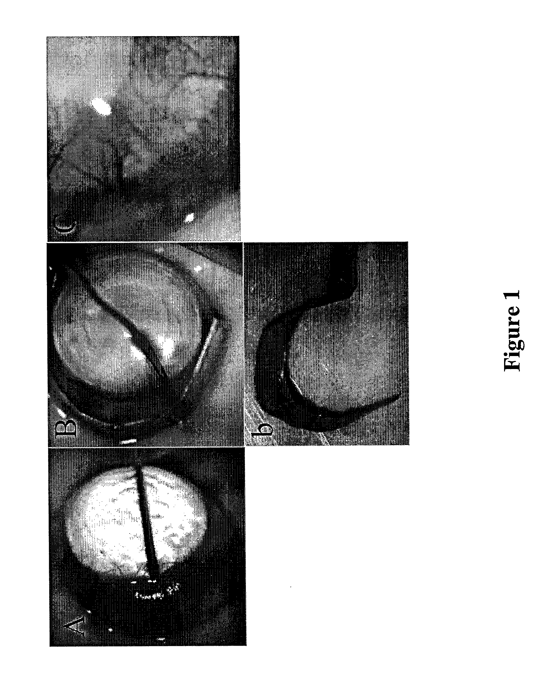 Methods And Devices For Delivering A Therapeutic Product To The Ocular Sphere Of A Subject
