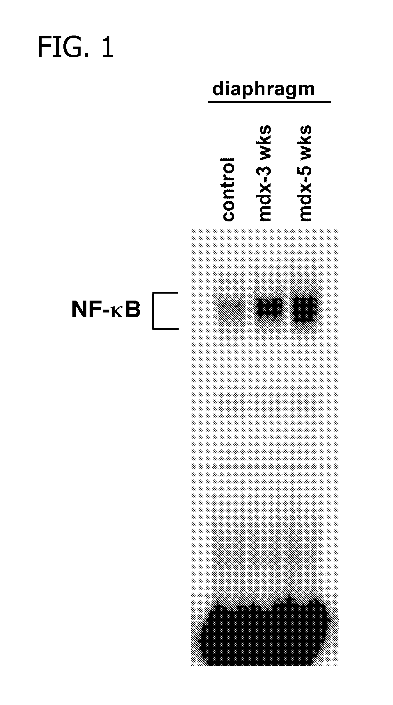 Methods of Treating Muscular Wasting Diseases Using NF-kB Activation Inhibitors