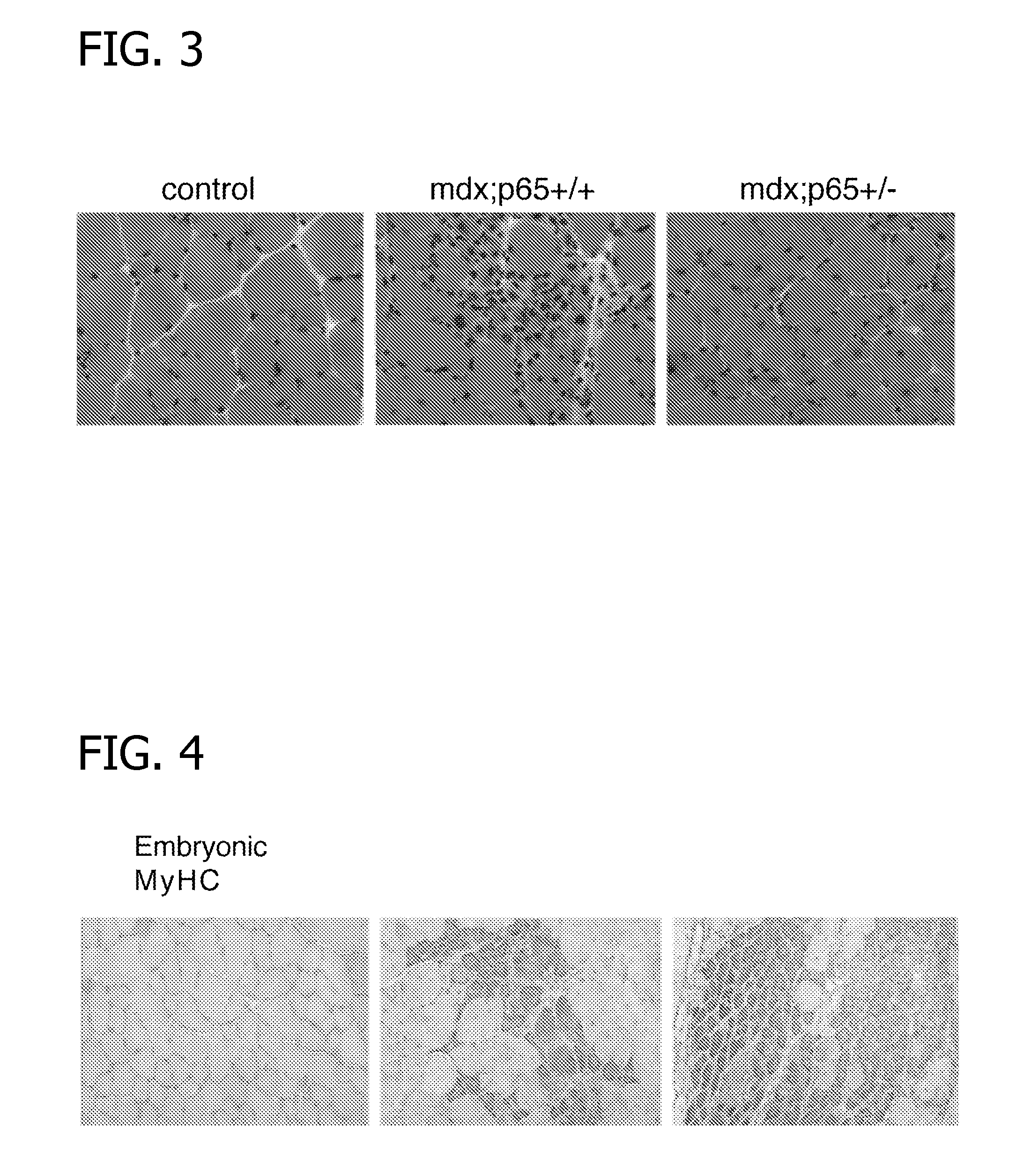Methods of Treating Muscular Wasting Diseases Using NF-kB Activation Inhibitors