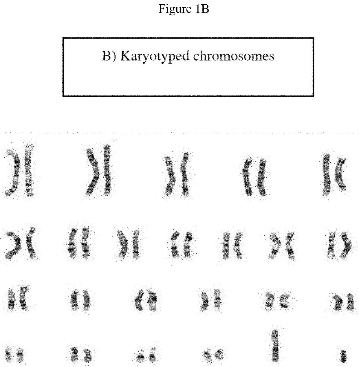 Chromosomal enhancement and automatic detection of chromosomal abnormalities using chromosomal ideograms