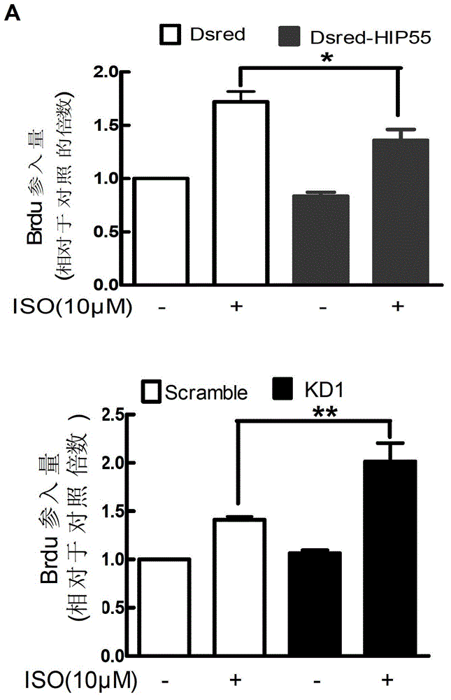 RNA(Ribonucleic Acid)and application thereof in diseases of cardiovascular system