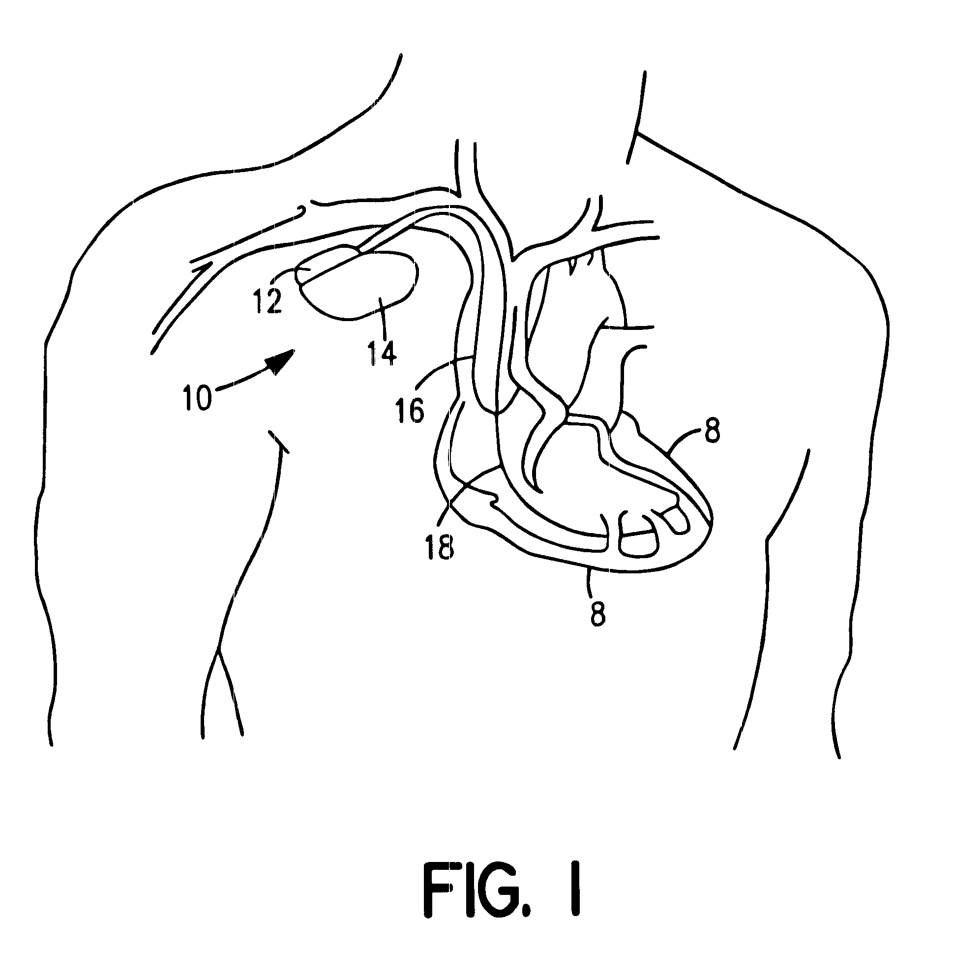 Implantable medical device telemetry control systems and methods of use