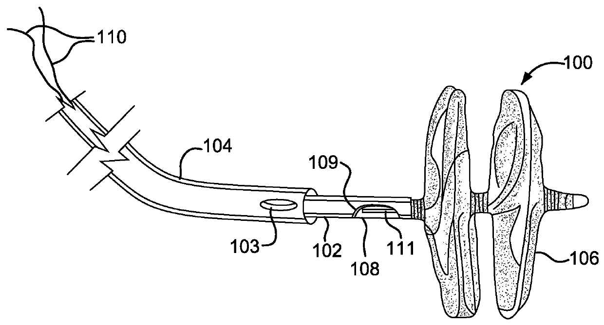 Sealing device and delivery system