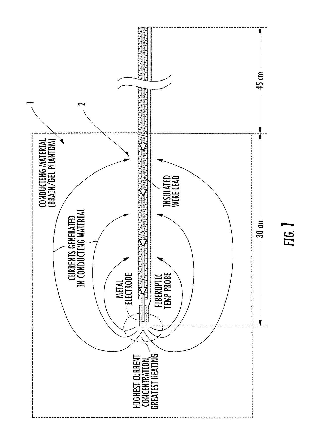 MRI and RF compatible leads and related methods of operating and fabricating leads