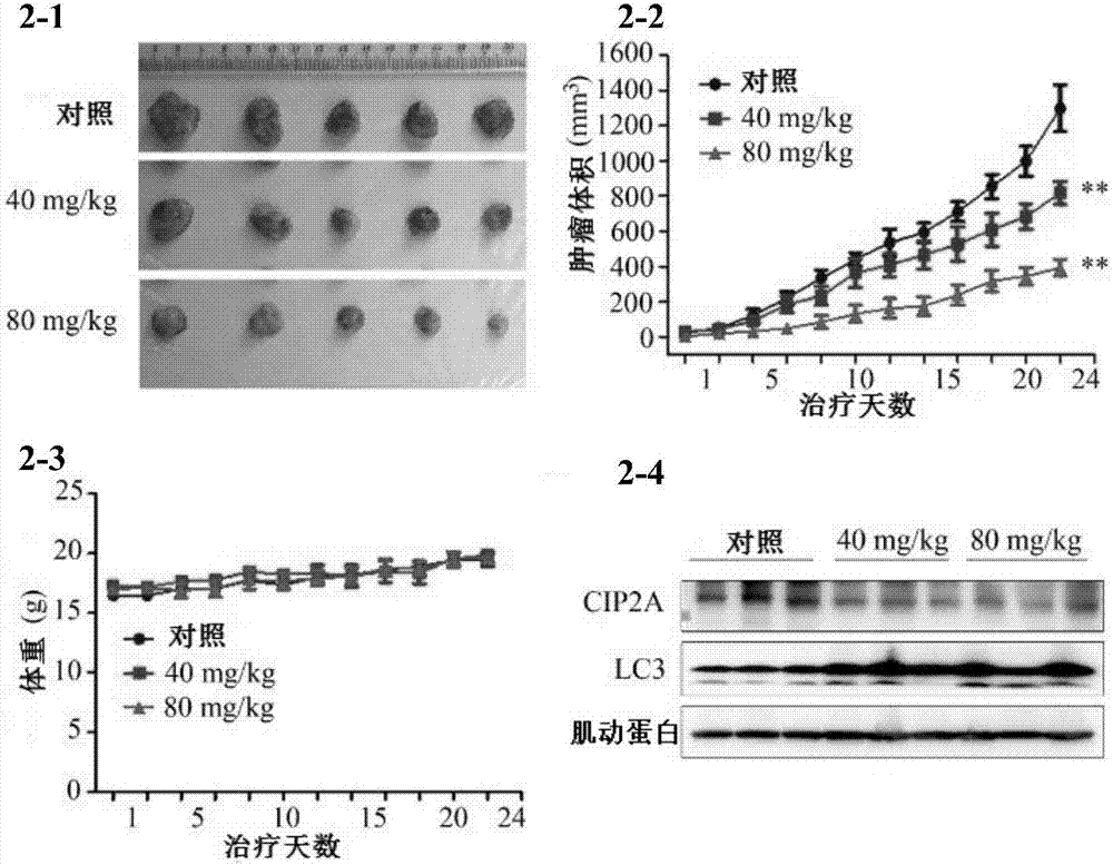 Application of ellagic acid and tripterine for synergically preparing anti-lung cancer drug