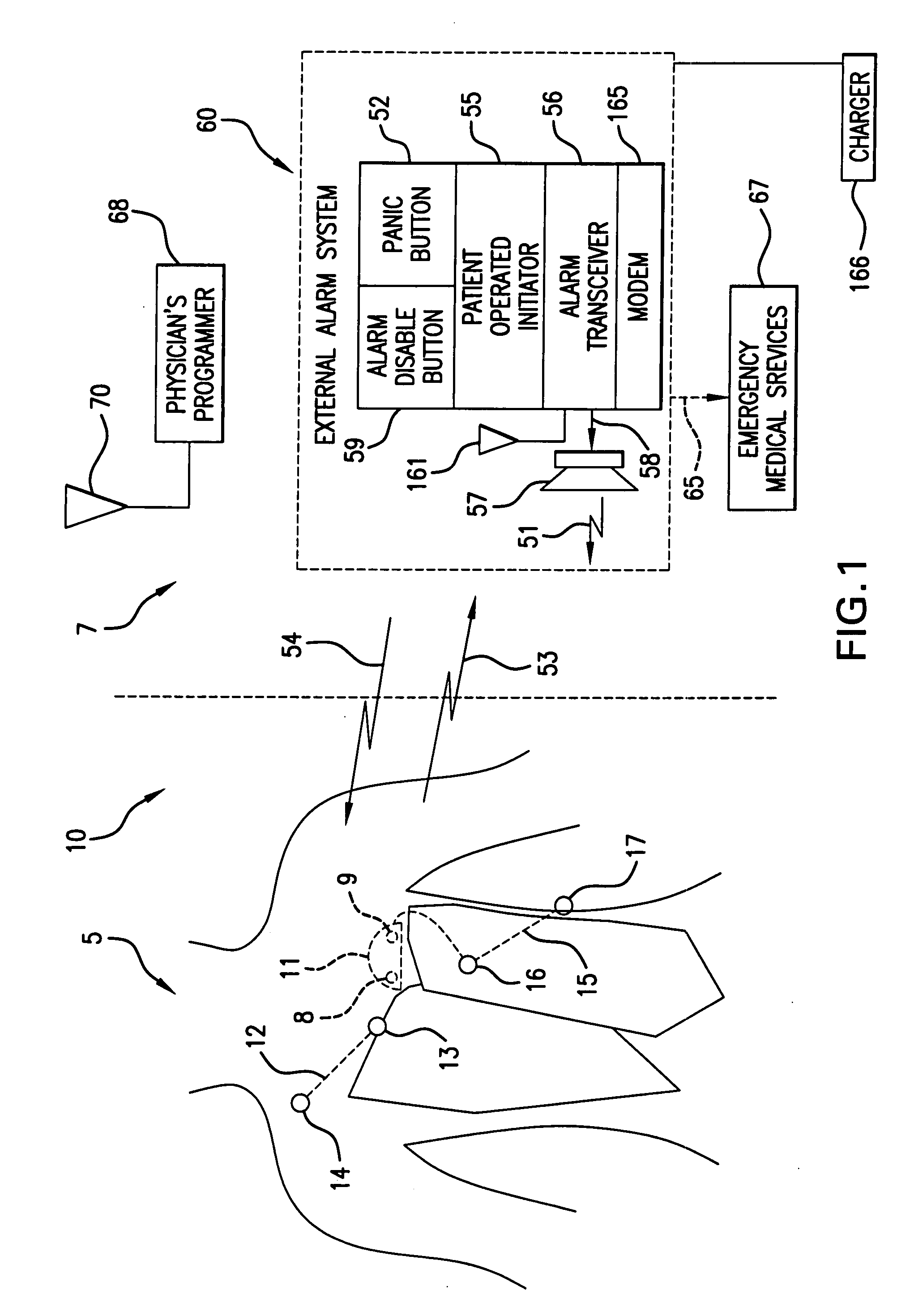 Waveform feature value averaging system and methods for the detection of cardiac events