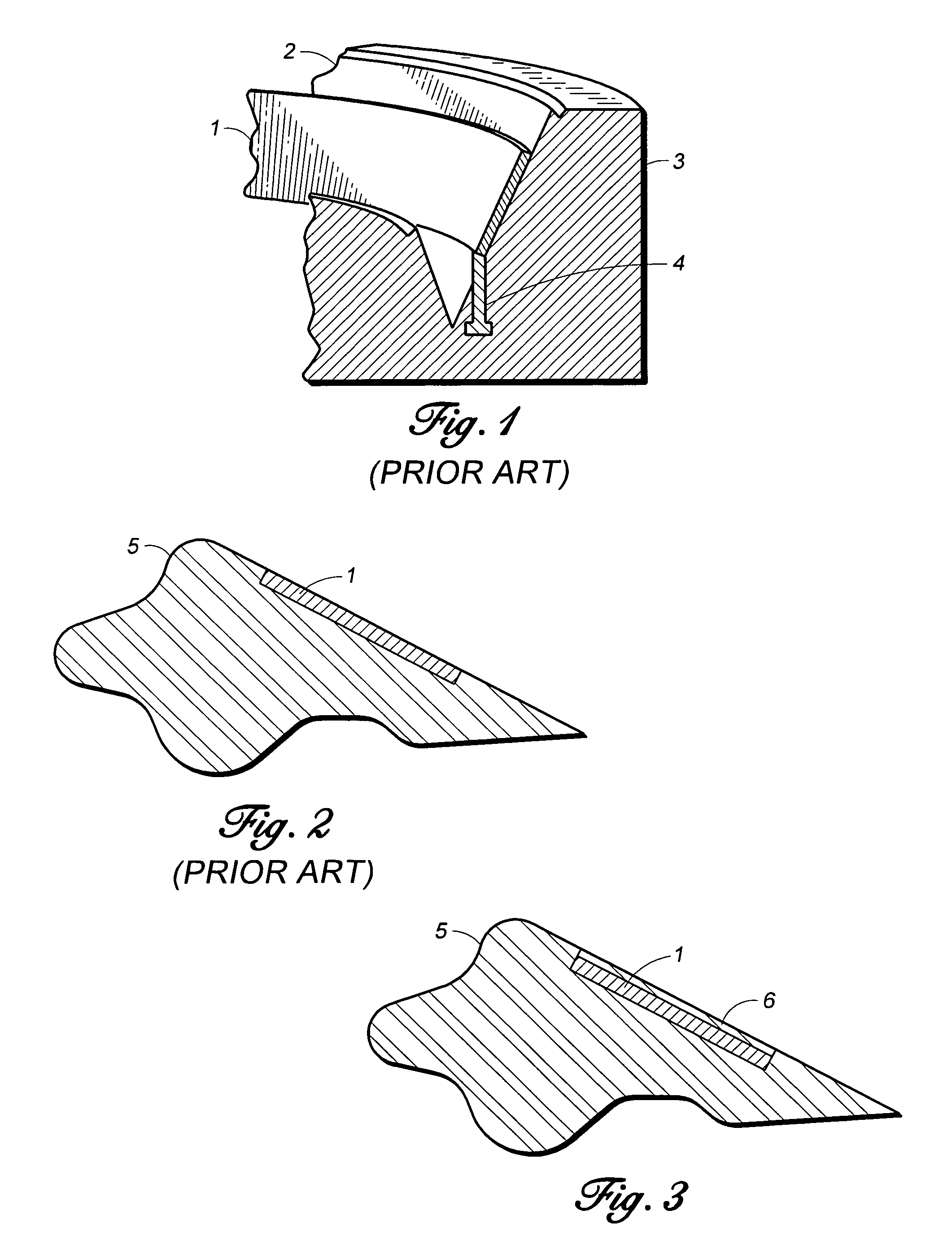 Method for manufacturing a gasket with an encapsulated metal band