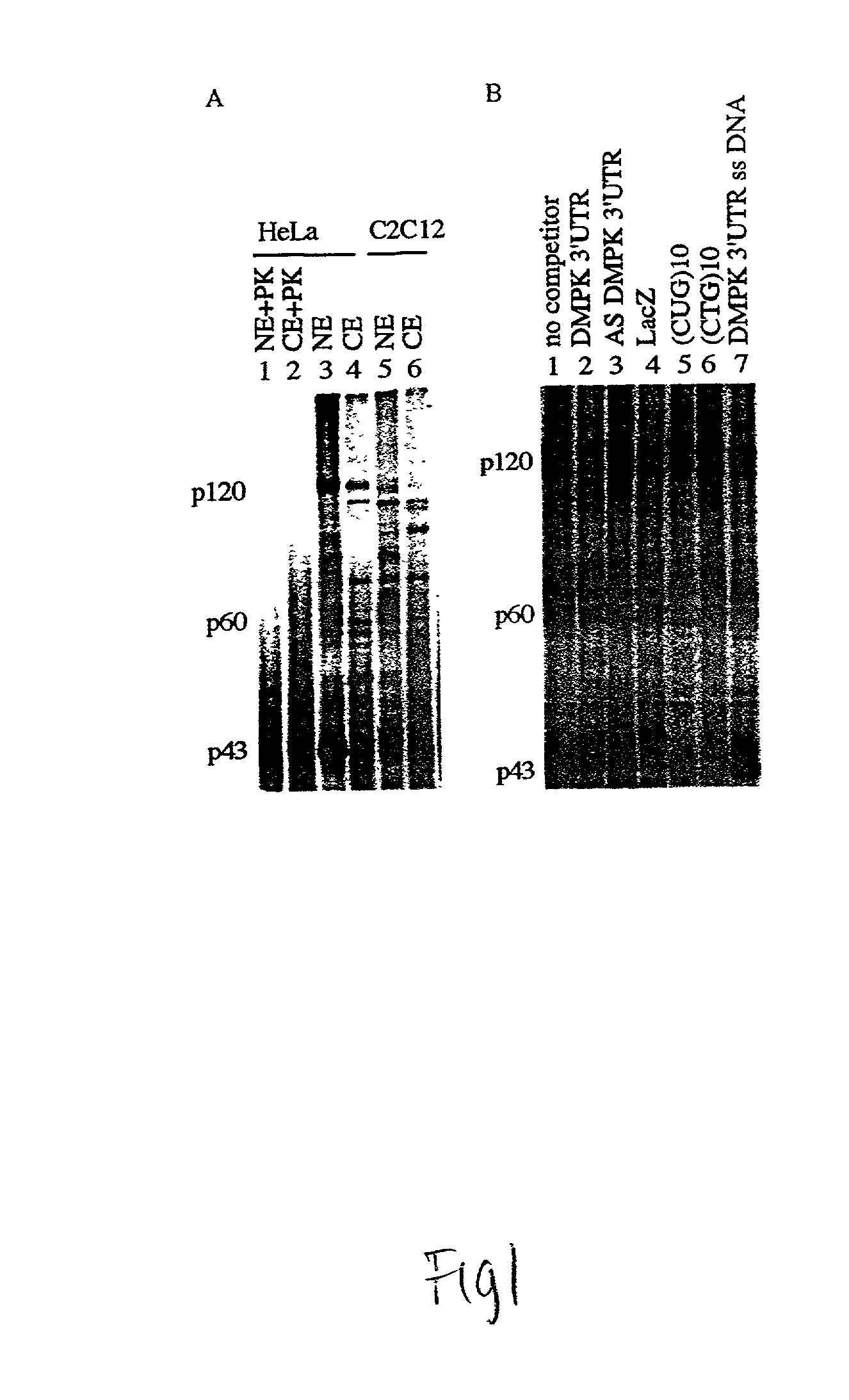 Novel isoform of myotonic dystrophy associated protein kinase and uses thereof