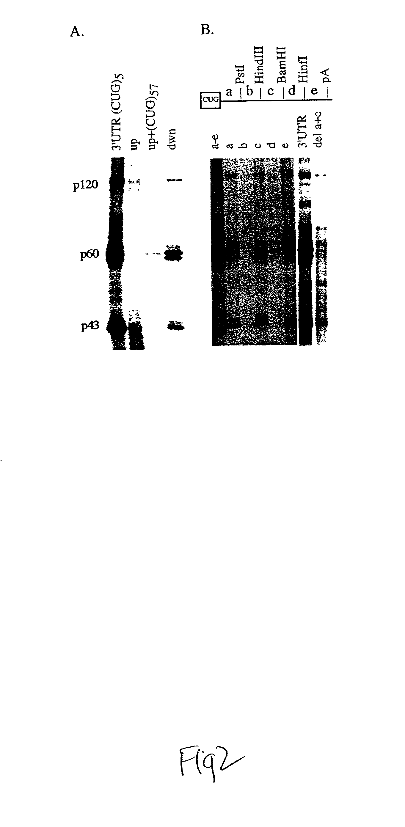 Novel isoform of myotonic dystrophy associated protein kinase and uses thereof