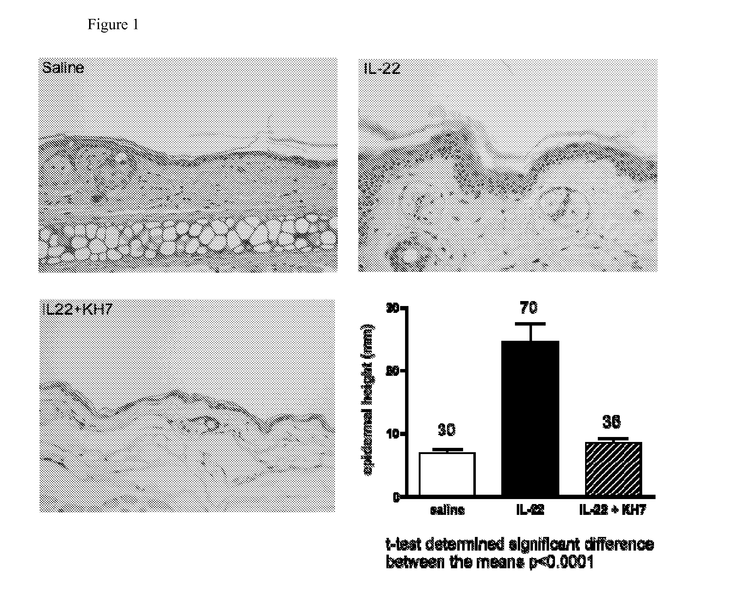 Method to treat psoriasis and other hyperproliferative skin disorders