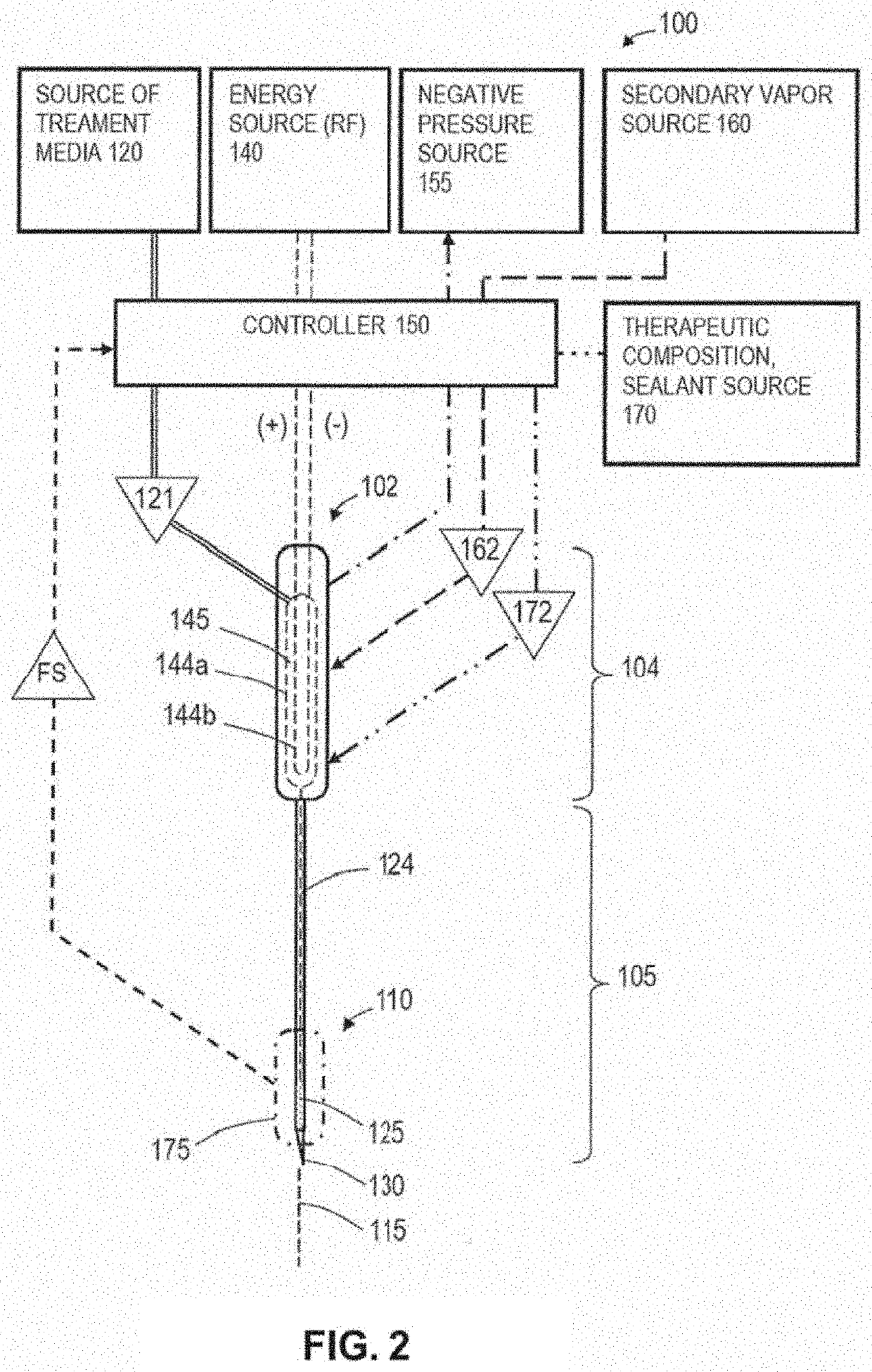 Medical system and method of use