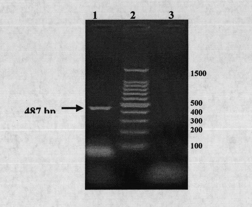 PCR (Polymerase Chain Reaction) and fluorescent PCR rapid detection method of bee sacbrood diseases