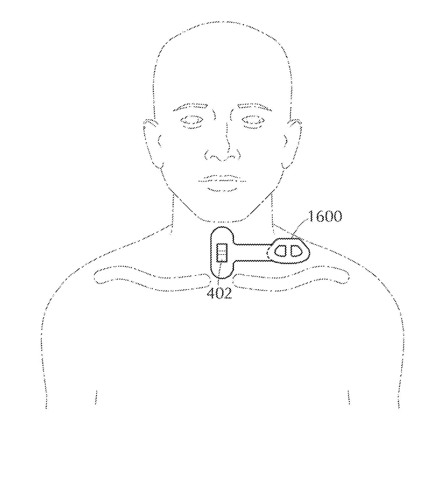 Device and Method for Self-Positioning of a Stimulation Device to Activate Brown Adipose Tissue Depot in a Supraclavicular Fossa Region