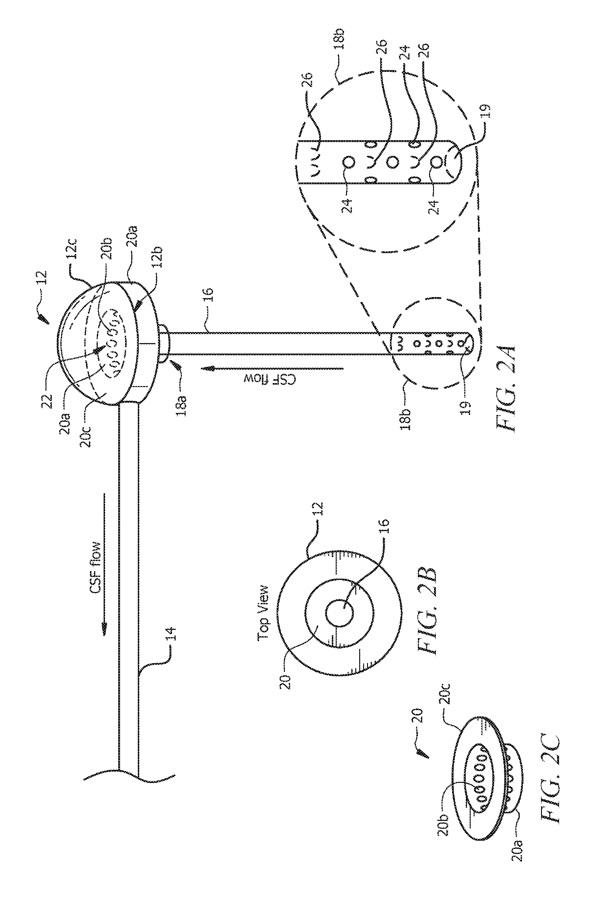 Shunt catheter system