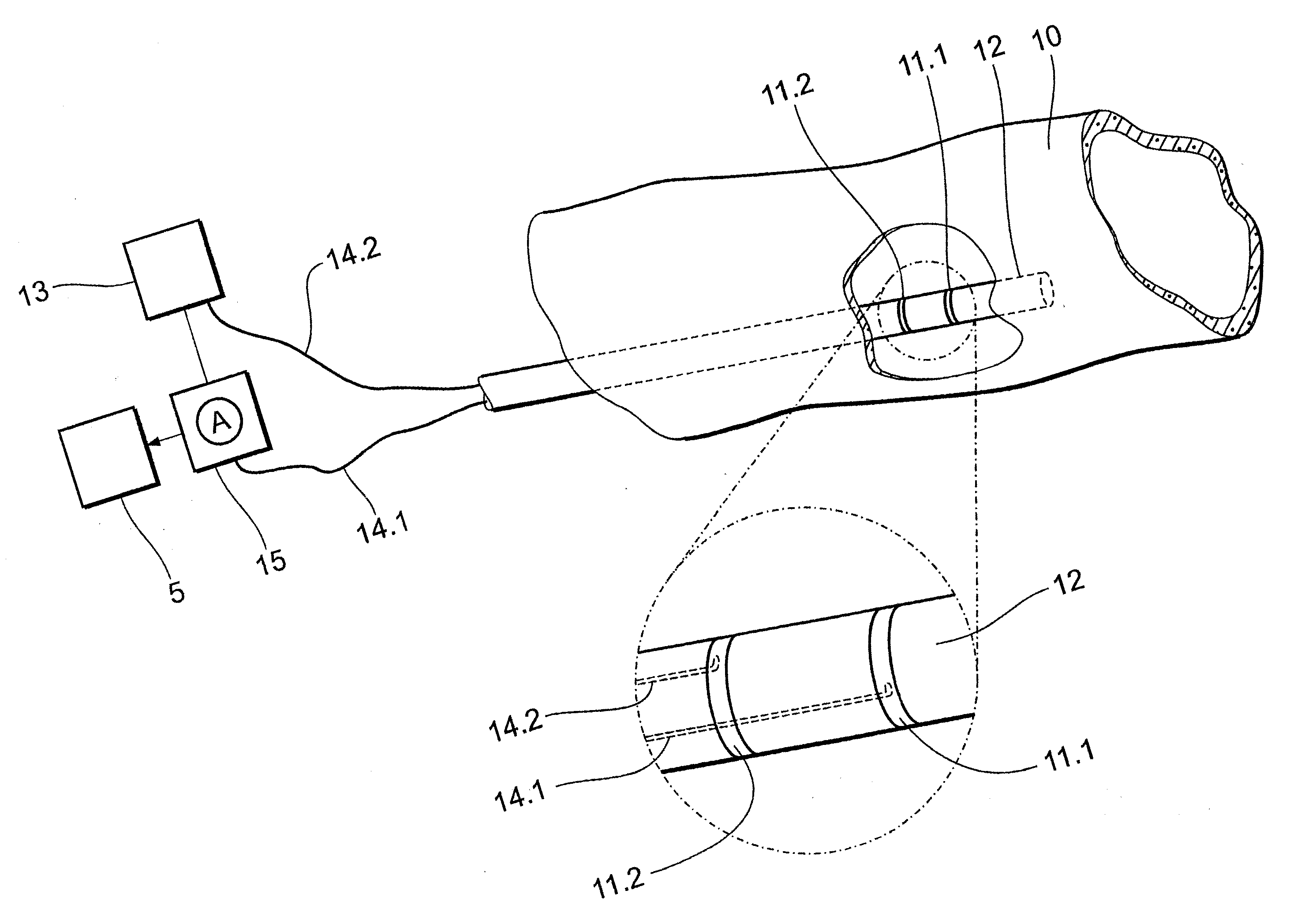 Electrical therapy device