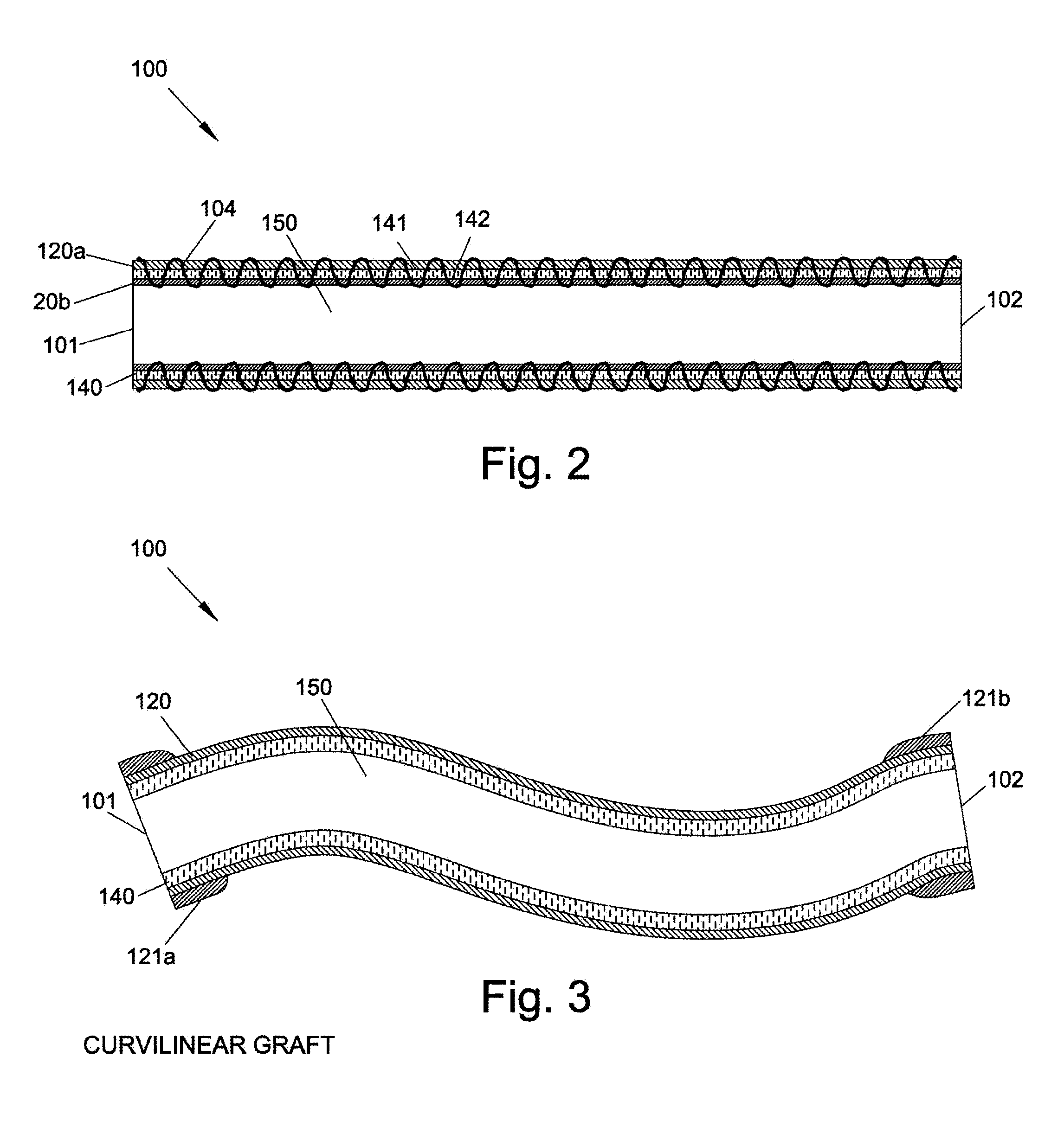 Graft Devices and Methods of Fabrication