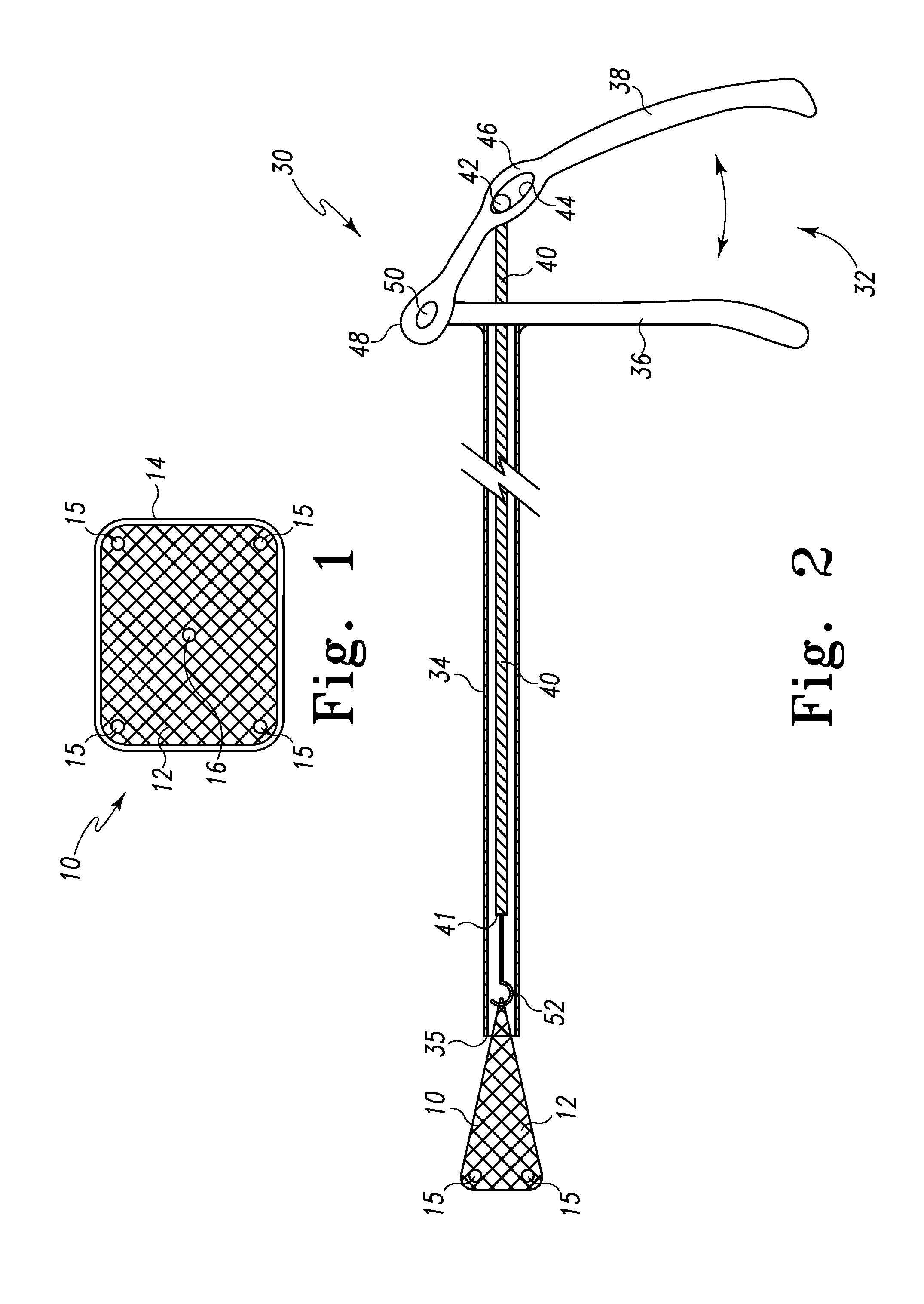 Repair System for Spinal Disc Herniation