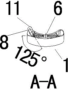 Lateral malleolus bone plate