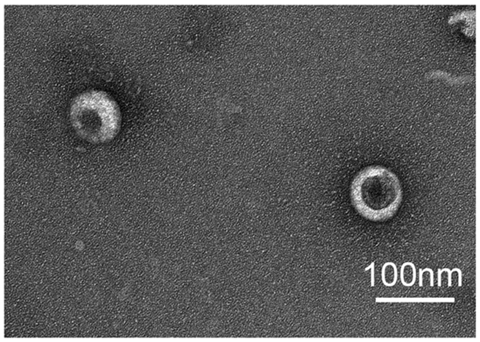 A kind of m1 macrophage exosome vaccine and its preparation method and application