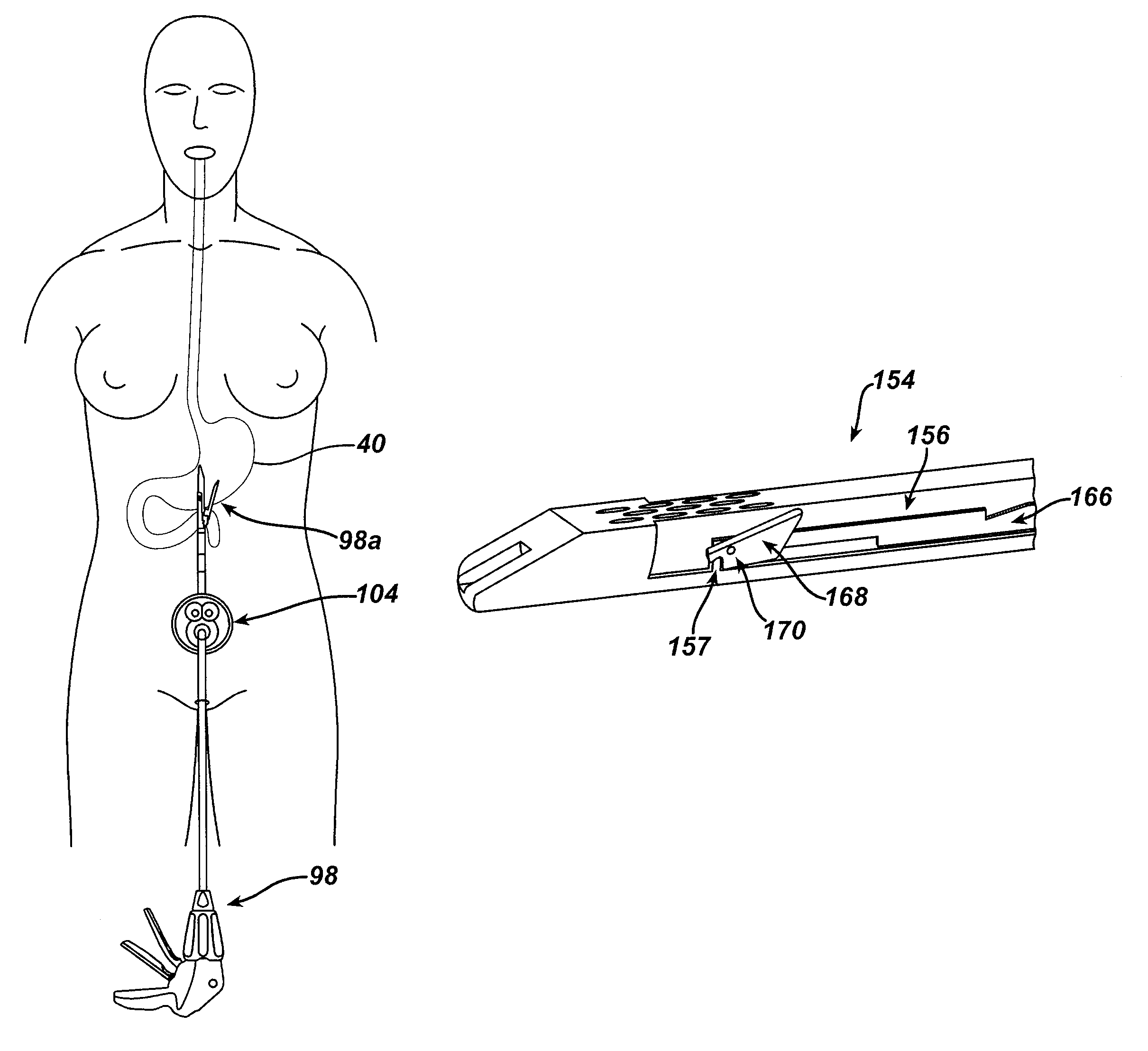 Methods and devices for cutting and fastening tissue