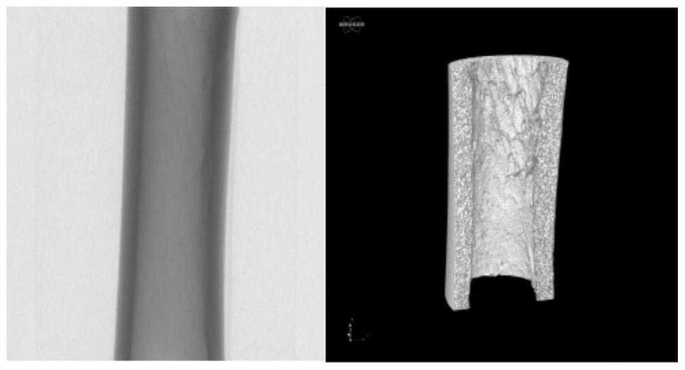 An individualized and customized zirconia porous biological bone repair scaffold based on light-curing 3D printing technology and its preparation method