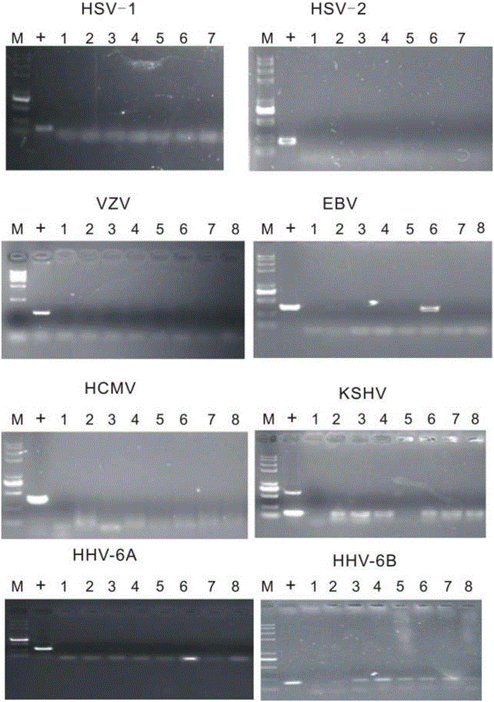 Reagent for rapidly detecting and quantifying subtypes of human herpes viruses and kit