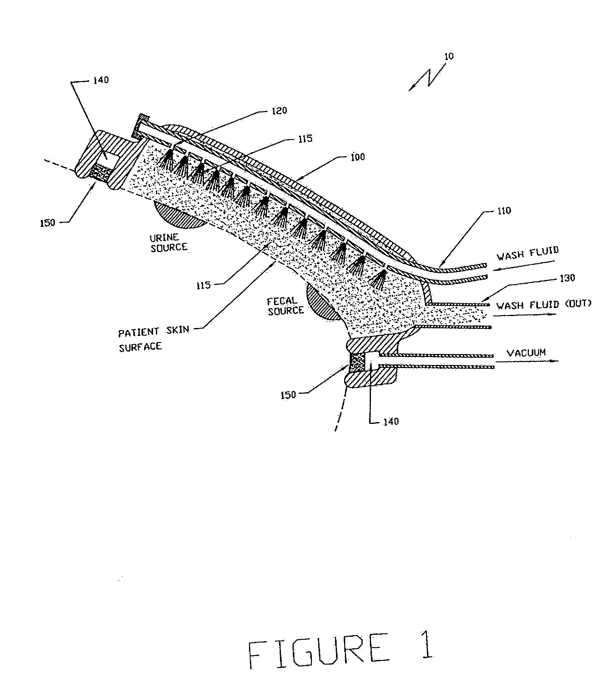 Apparatus and Method for the Removal and Containment of Human Waste Excretion