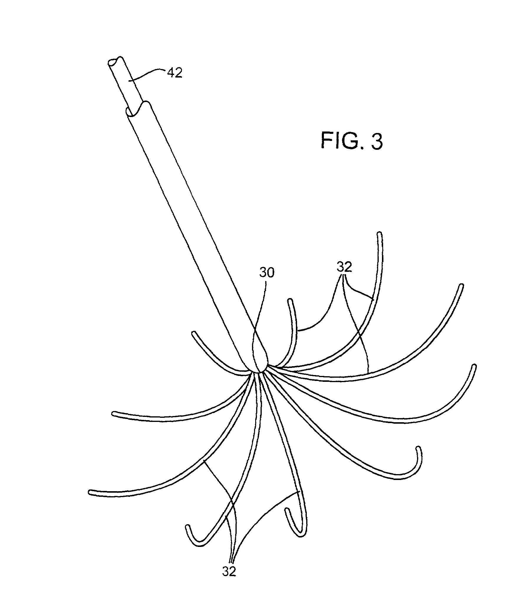 Apparatus and method for treating tumors near the surface of an organ